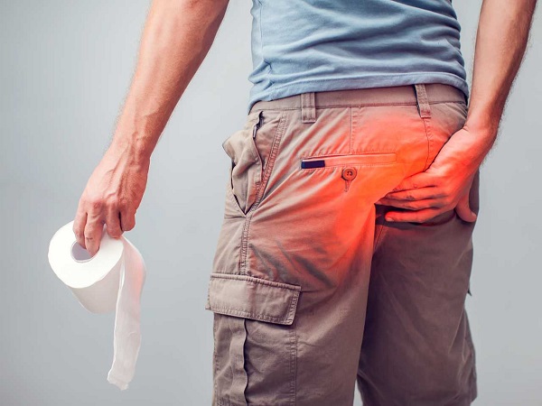 Anal Fistül Nedir? Anal Fistül Nedir?