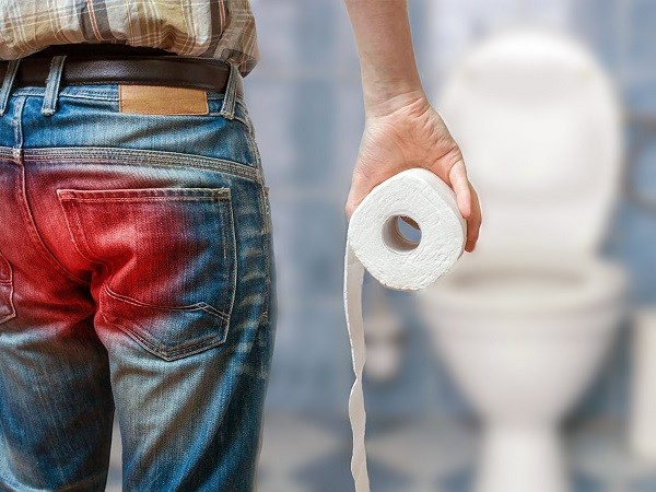 Anal Fistül Tedavisi Anal Fistül Tedavisi