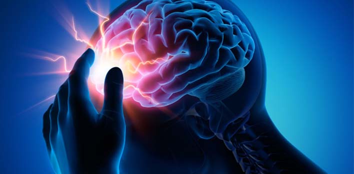 Epilepsi Nedir? Epilepsi Nedir?