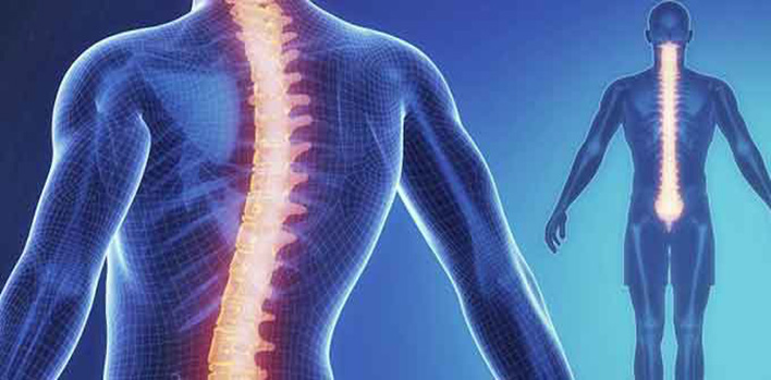 What is Scoliosis?