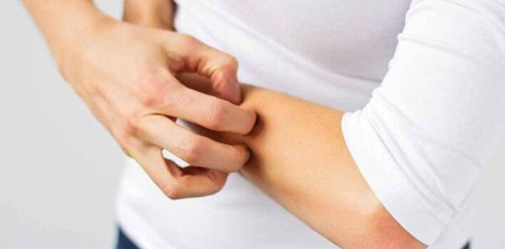 How Zona Disease Occurs and how treatment is performed How Zona Disease Occurs and how treatment is performed